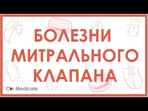 Болезни митрального клапана. Пролапс митрального клапана, стеноз, регургитация.