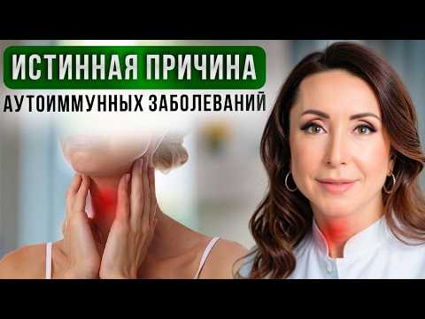 Hormones, diet, and supplements—how to treat autoimmune thyroiditis? The main cause of autoimmune...