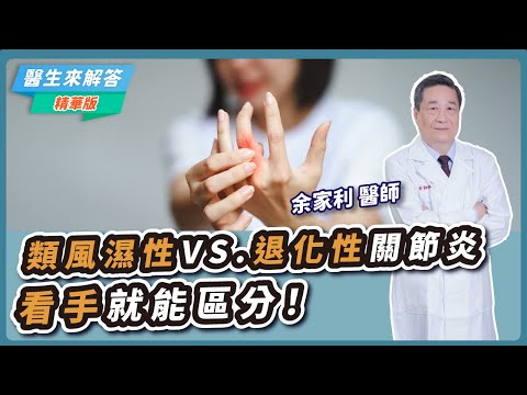 【醫生來解答－聽醫生的話@icare愛健康】類風濕性VS.退化性關節炎 看手就能區分！｜專訪：余家利 醫師
