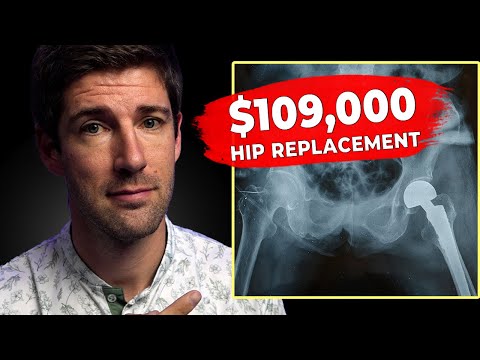 How Much Would You Pay on a $109,000 Hip Replacement: ACA vs Medicare Explained 💰