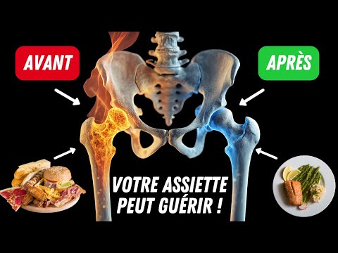TOP 10 des aliments ANTI-ARTHROSE qui réduisent l’inflammation naturellement et sans médicament
