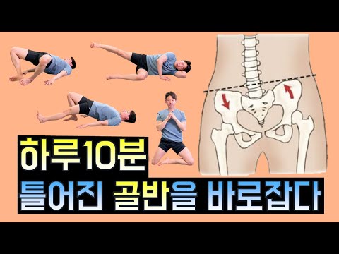 [Pelvic Correction Special] Pelvic distortion, pelvic asymmetry, anterior tilt, posterior tilt, a...