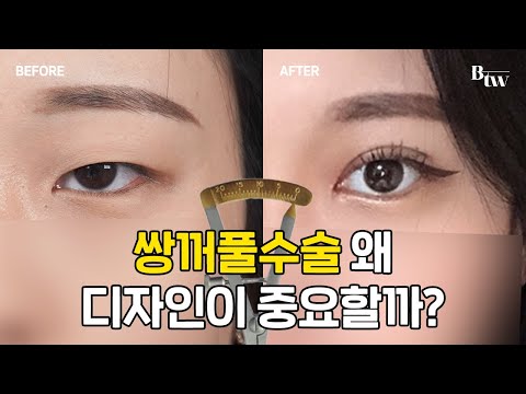 쌍꺼풀 수술 왜 디자인이 중요할까? | BTW성형외과
