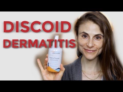 DISCOID (NUMMULAR) DERMATITIS: TIPS FROM A DERMATOLOGIST| DR DRAY