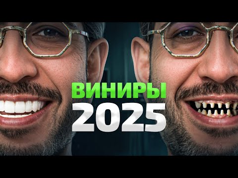 Никогда так НЕ делай! Ошибки установки виниров в 2025 году