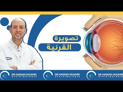 راديو القرنية - الدكتور حسن أولهري -