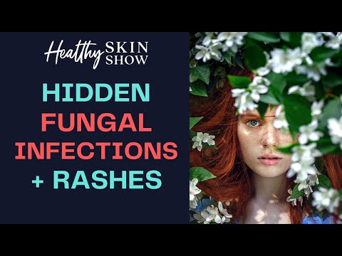 How HIDDEN Fungal Infections Can Cause Skin Rashes | Dr. Jess Peatross