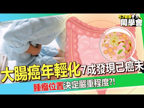 【精選】大腸癌年輕化「50歲以下病患暴增三成」?! 腫瘤位置決定「嚴重程度」7成發現已是癌末?! 【57健康同學會】 @57healthy