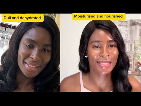 How I Achieved Attractive, Glowing  Black Skin | Ingredients & Products That Works. Body Care