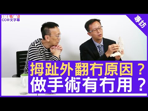 拇趾外翻冇原因?做手術有冇用?香港港安醫院—司徒拔道#骨科專科醫生#沙惠良醫生鄭丹瑞《健康旦》(CC中文字幕)