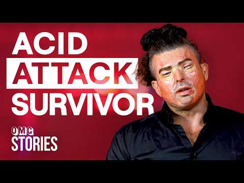 A Pint Of Acid To The Face Changed My Life Forever | OMG Stories