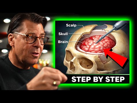 Neurosurgeon Explains Brain Surgery Step By Step | Dr. Brian Hoeflinger