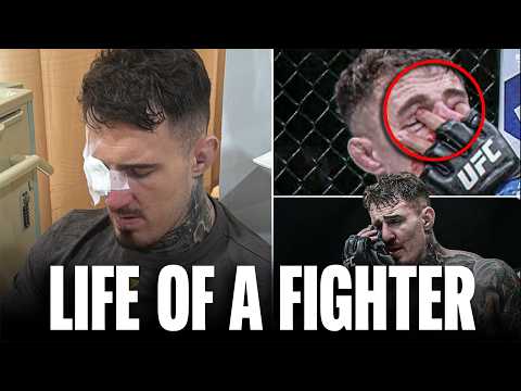 The Truth Behind Tom Aspinall's UFC 321 Eye Poke