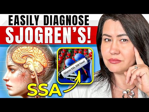 Essential Sjogren's Disease Tests to Ask Your Doctor About NOW