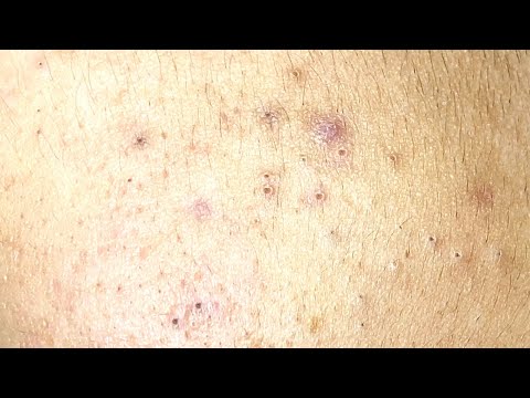 Relax Every Day With Sac Dep Spa #0202