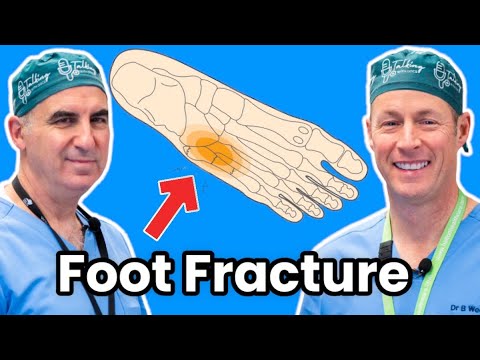 Jones and Fifth Metatarsal Fractures. How To Treat Your Broken Foot