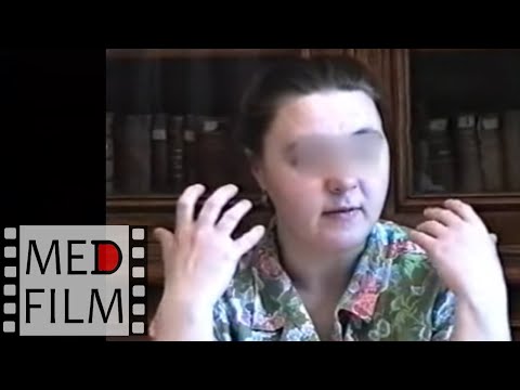 "Fankogols. Planet of poppies" Schizophrenia, Delusions, Kandinsky-Clerambo Syndrome ©