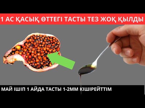 Күнде 1 АС ҚАСЫҚ өттегі ТАСТЫ 1айда тез арада ерітті. Өттегі тасты қалай ерітуге болады?