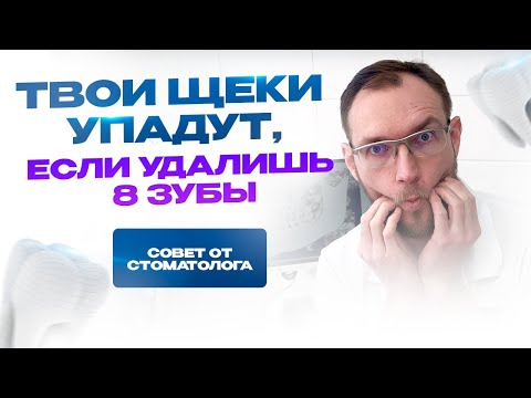 Твои щеки упадут, если ты удалишь 8 зубы (зубы мудрости). Стоматолог Стас Белоус