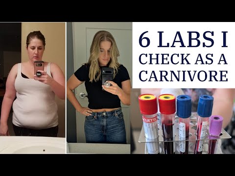 6 Labs I ALWAYS Check as a Carnivore & My Results 