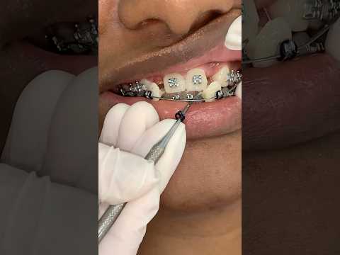 His Teeth POPPED Right Out?! 😮🦷