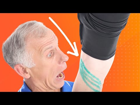 Is This Small Muscle Behind Your Knee Causing Pain?