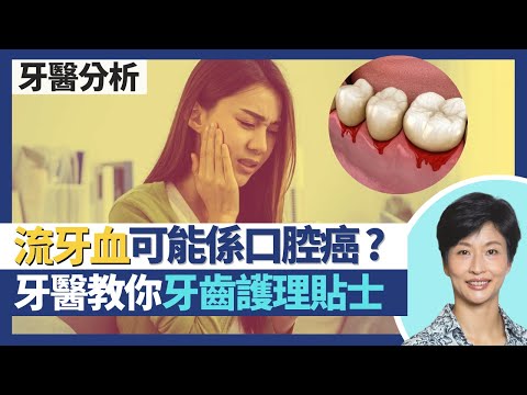 流牙血｜可能是口腔癌 覺痛已是晚期？牙醫分享日常牙齒護理貼士！香港人口腔健康差：12歲兒童86%有牙齦炎牙周病 某年齡層得1%人牙肉健康｜王建芳醫生 牙科醫生李錦賓醫生｜人類健康研究所