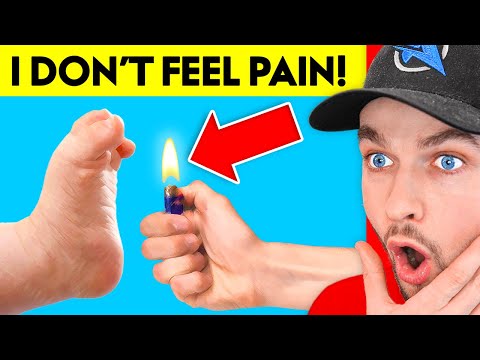 I Canโt Feel PAIN! (True Story Animation)