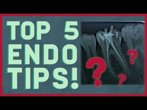 The Best 5 Root Canal Tips, Period