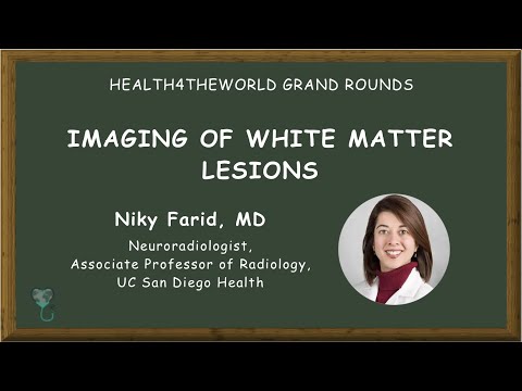 Imaging of White Matter Lesions