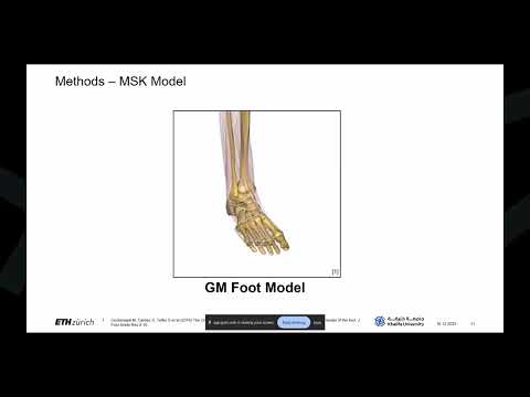 Evaluation of a universal talus implant during gait: A combined MSK and FE modelling approach