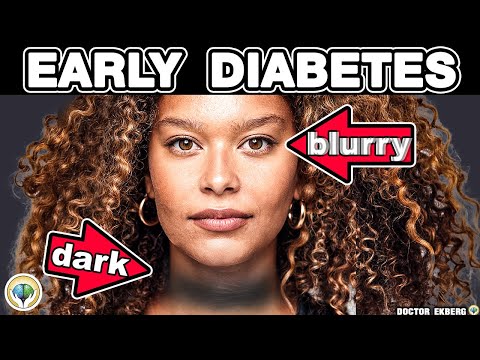 10 Early Diabetes Signs You Must Not Ignore