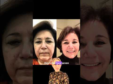 Regaining confidence in your skin