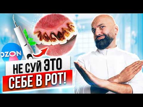 Тестируем зубной скалер с Озон | Получится ли сэкономить на чистке зубного камня у стоматолога?