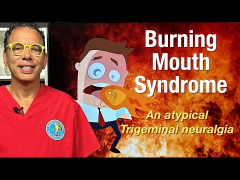 Burning mouth syndrome- How to know if a neck component is behind burning tongue & mouth symptoms