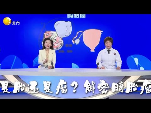 健康朋友圈 20250417：是胎還是瘤？解密畸胎瘤