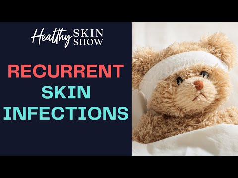 TOP Tips To STOP Recurring STAPH Skin Infections | Dr. Peter Lio