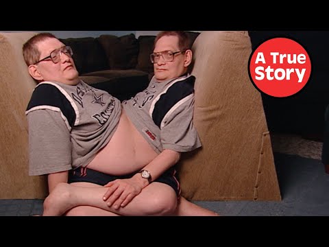 The World's Oldest Conjoined Twins: The FULL Documentary | A True Story
