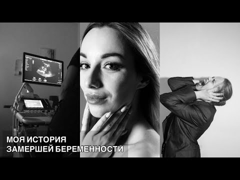 МОЯ ИСТОРИЯ ЗАМЕРШЕЙ БЕРЕМЕННОСТИ