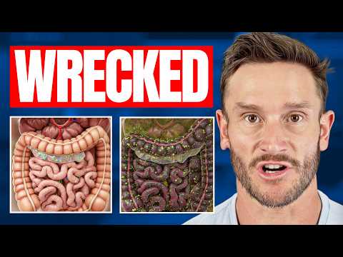 Gut Inflammation Starts with These 9 Foods (within minutes)