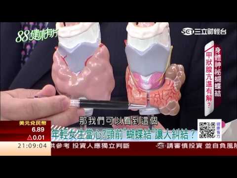 身體的神祕蝴蝶結 甲狀腺亢進有解?｜健康有方20170405｜三立台灣台CH29