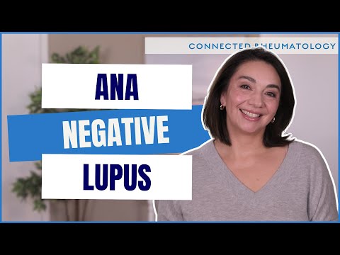 What we know about ANA negative Lupus and how to navigate this tricky situation