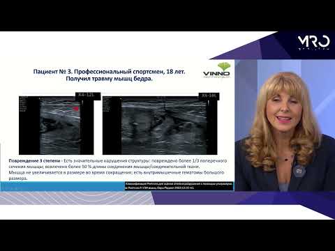 Ультразвуковая диагностика патологии тканей опорно-двигательного аппарата на клинических примерах