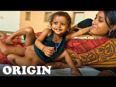 The Girl With 8 Limbs: Can She Ever Live A Normal Life? | Full Documentary