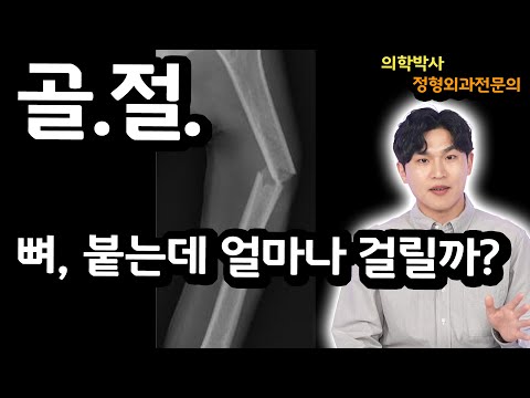 부러진 뼈 (골절) 붙는데 걸리는 기간?