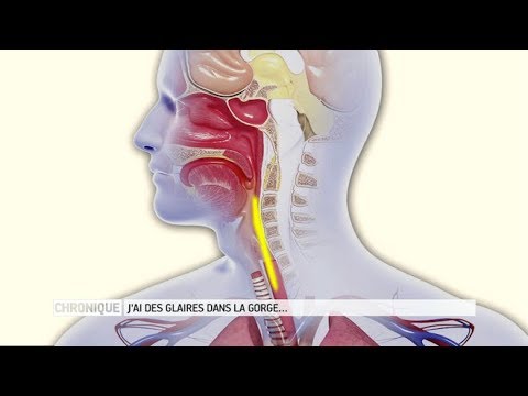 Mucus in the throat: how to get rid of it? - The Health Magazine