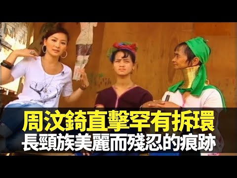 長頸族美麗而殘忍的痕跡 周汶錡直擊罕有拆頸環過程｜X光片拆解長頸之謎 每日酸性清洗黃銅傷皮膚｜緬甸政府逼迫 女性火線下堅持民族傳統｜向世界出發 周汶錡