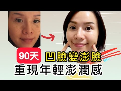 90天凹臉變澎澎臉｜平復老態、衰臉｜