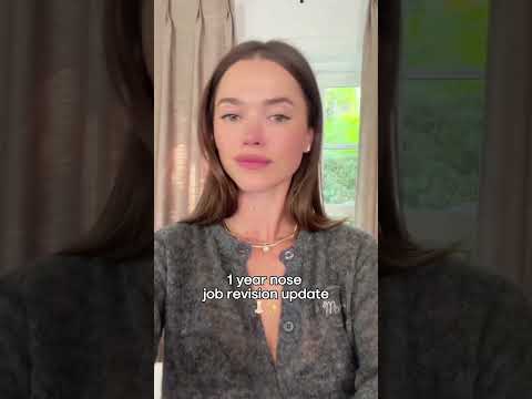 Couldn’t be happier with the decision to do a revision, but I won’t lie the recovery is a lot 👃🏻