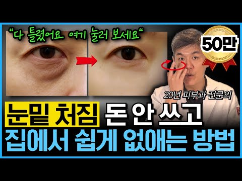 "집에서 여기 눌러보세요" 눈밑 처짐, 집에서 돈 안 쓰고 가장 쉽게 없애는 방법을 20년차 피부과 원장이 알려드립니다